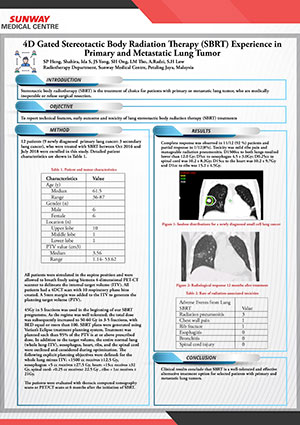 Stereotactic Body Radiation Therapy