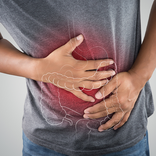 Colorectal cancer screening