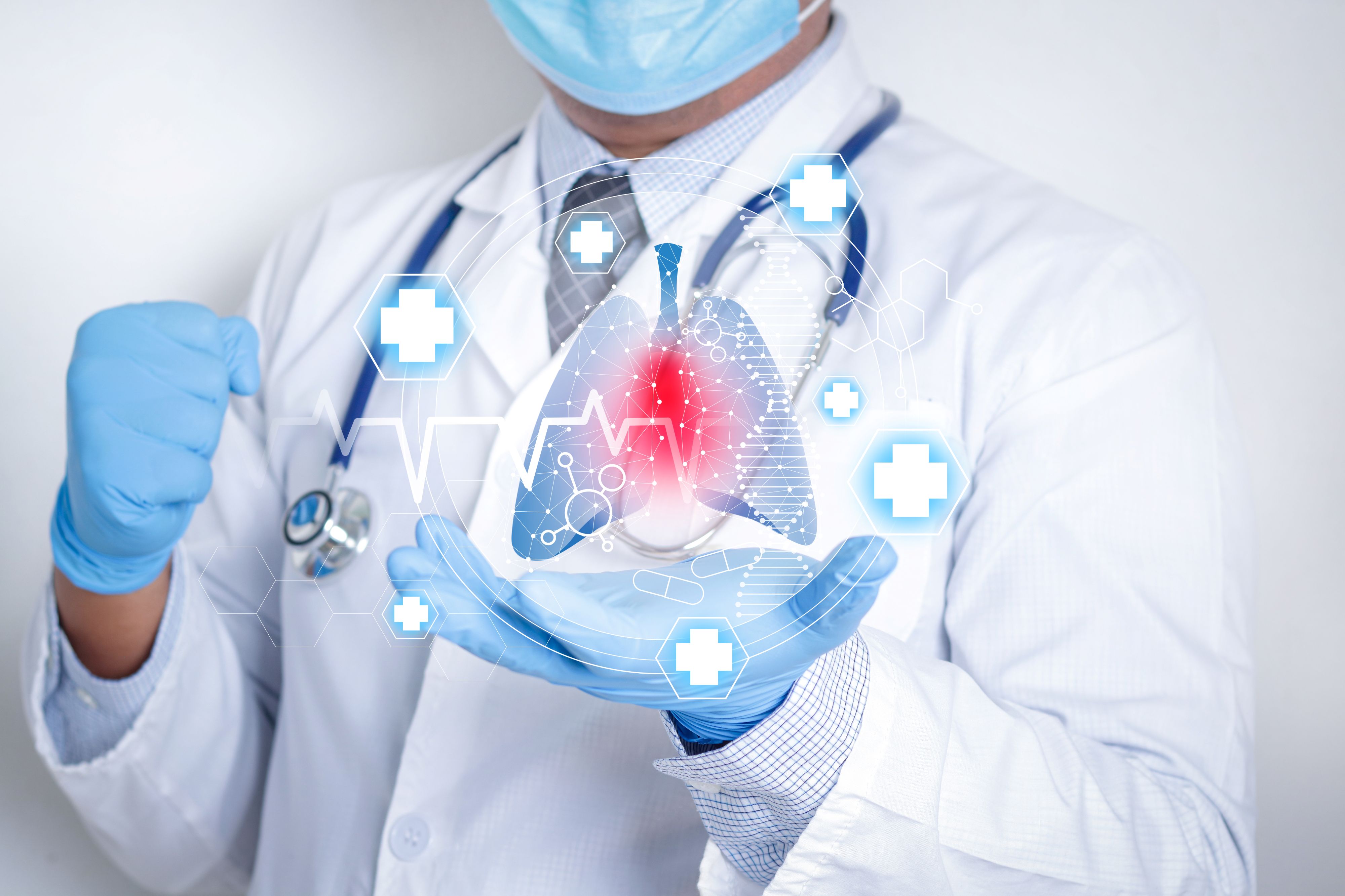 Lung Cancer MDT