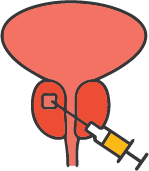 Biopsy