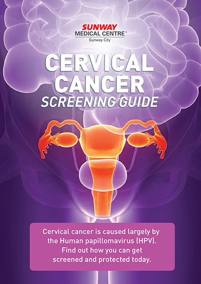 Cervical Cancer Screening Guide