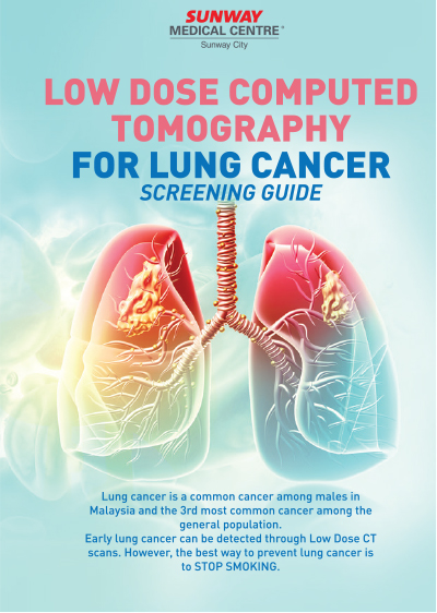 lung cancer handbook
