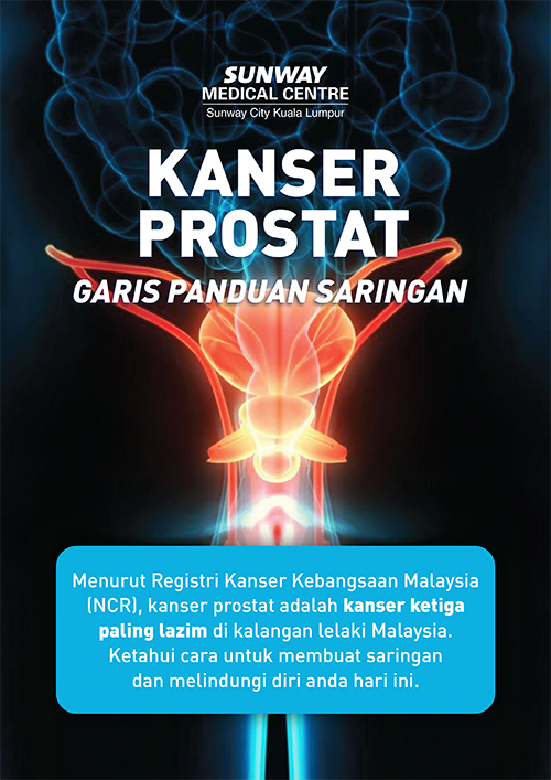 Prostate Cancer Screening Guidelines handbook