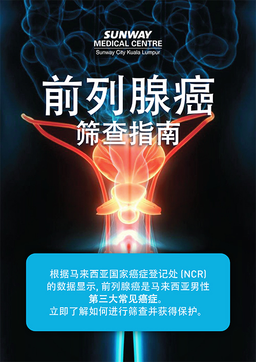 Prostate Cancer Screening Guidelines handbook