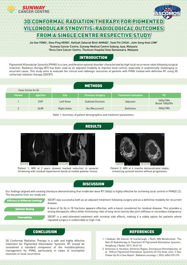 3D Conformal Radiation Therapy for Pigmented Villonodular Synovitis: Radiological Outcomes from a Single Centre Retrospective Study