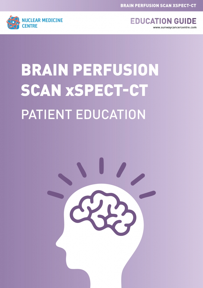 Brain Perfusion Scan x SPECT-CT