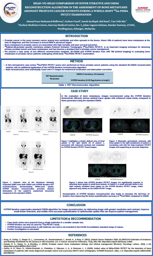 Head-To-Head Comparison Of HYPER Iterative And OSEM Reconstruction Algorithm In The Assessment Of Bone Metastasis Amongst Prostate Cancer Patients During A Whole-Body Ga-PSMA PET/CT Examination