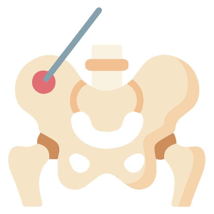 Bone Marrow Biopsy