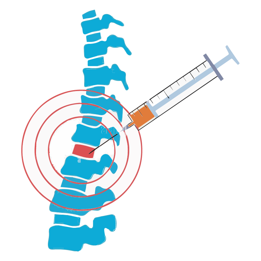 Lumbar Puncture