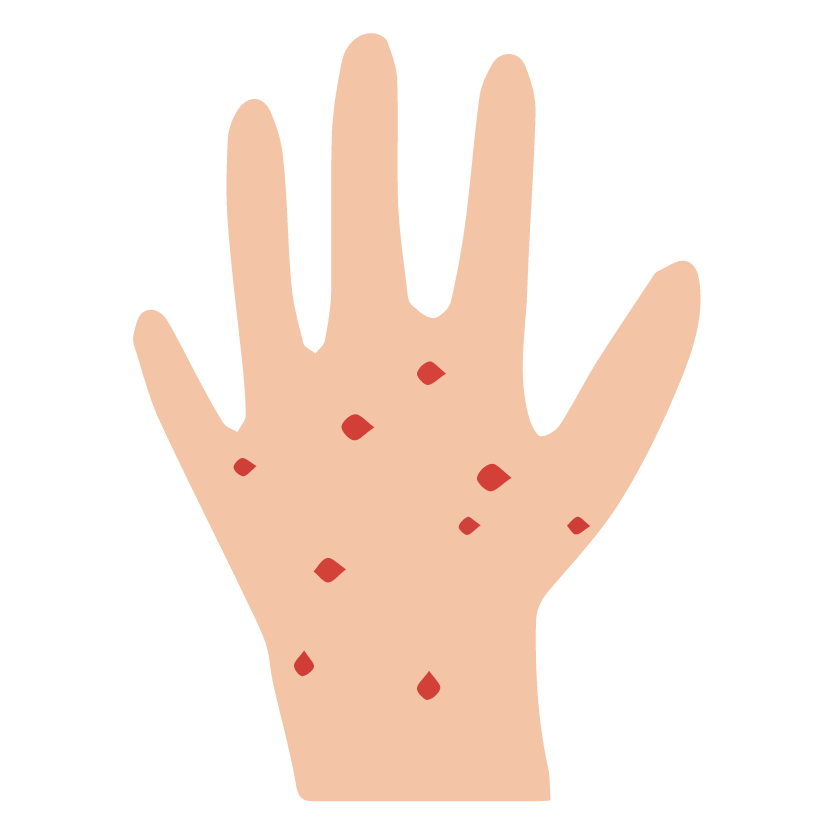 Tiny red spots in your skin (petechiae)