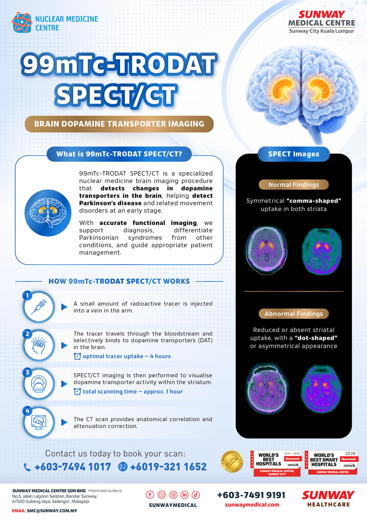 99mTc-TRODAT SPECT/CT Imaging