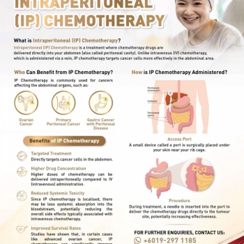 Intraperitoneal (IP) Chemotherapy